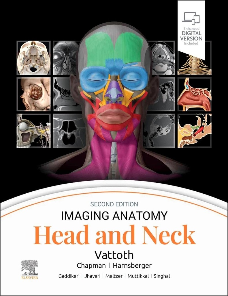 IMAGING ANATOMY:HEAD AND NECK