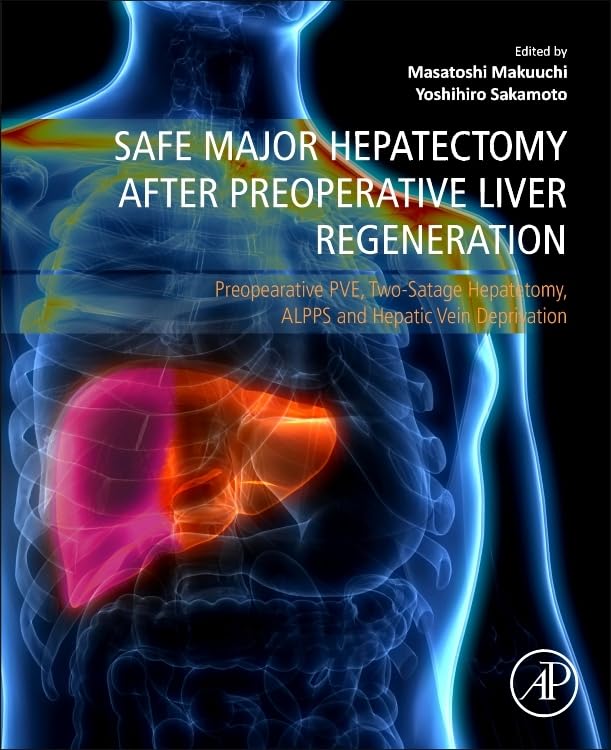 Safe major hepatectomy after preoperative liver regeneratio