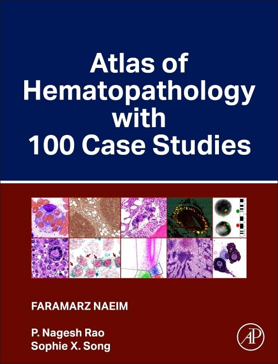 Atlas of hematopathology with 100 case studies