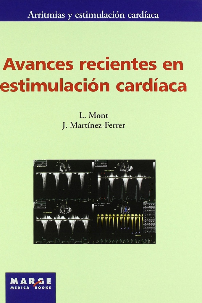 Avances recientes en estimulación cardíaca