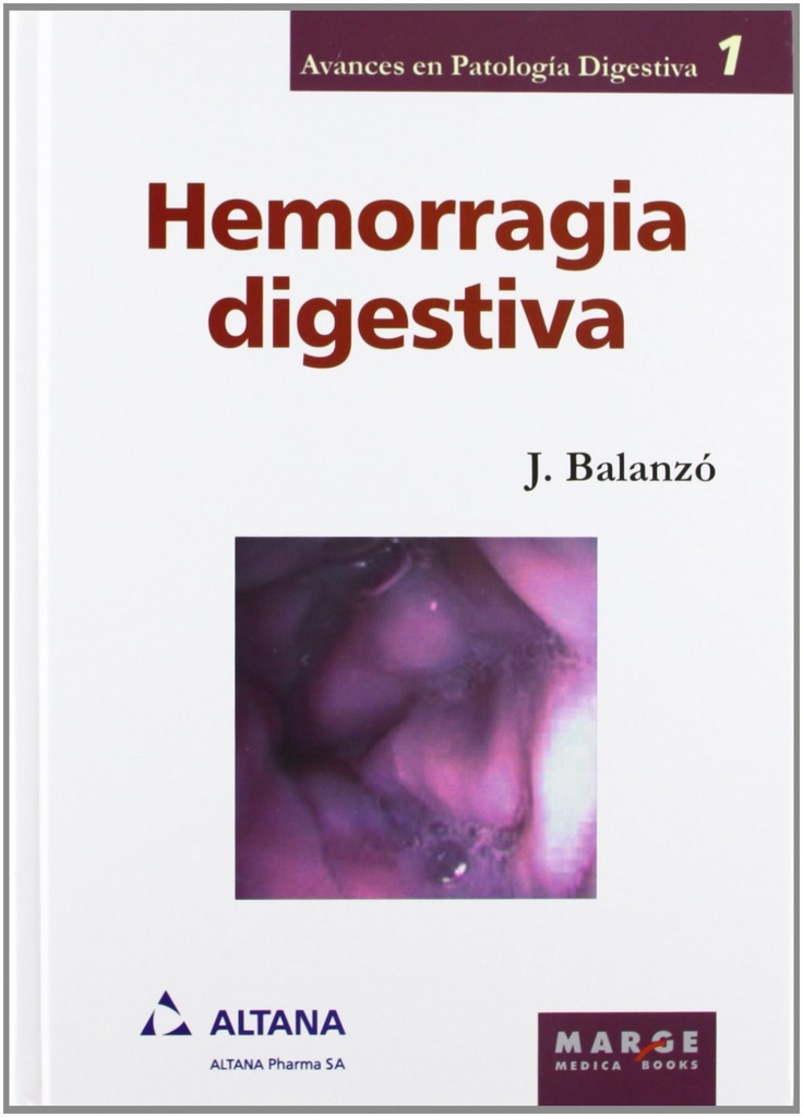 Hemorragia digestiva