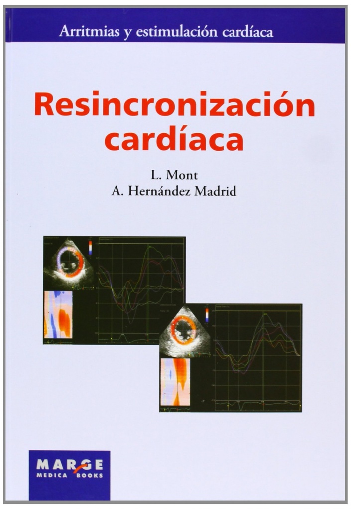 Resincronizacion cardiaca