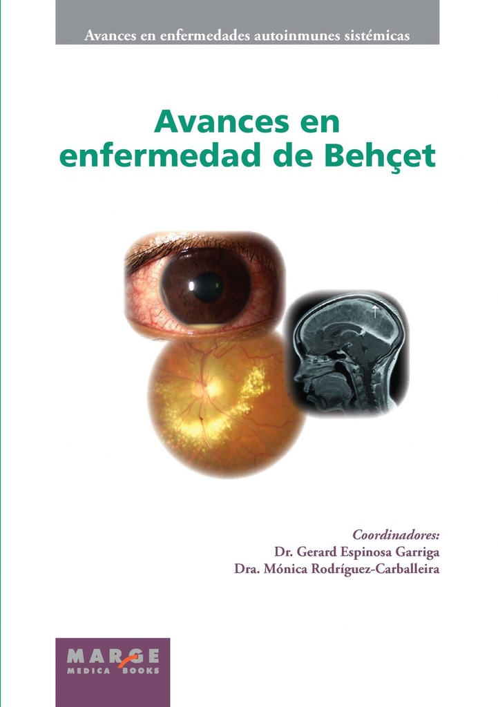 Avances en enfermedad de Behcet