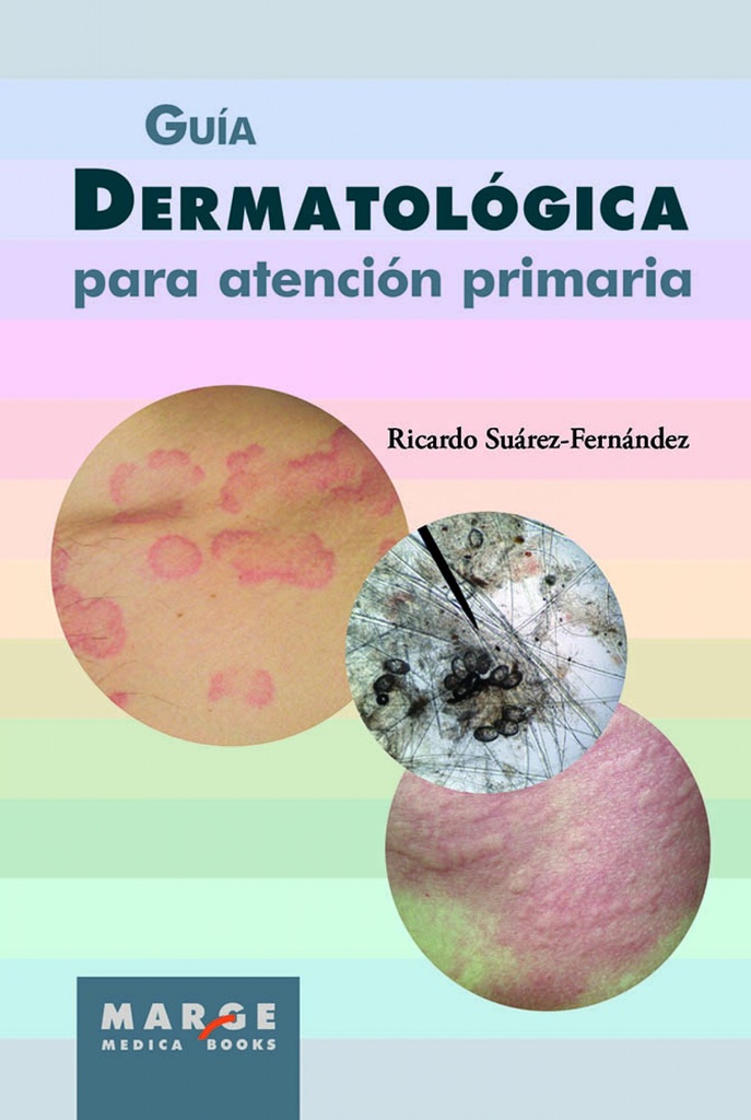 Guía dermatológica para atención primaria