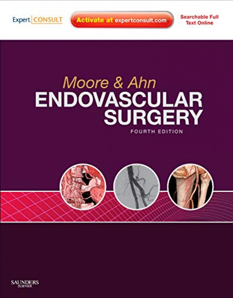 Endovascular surgery