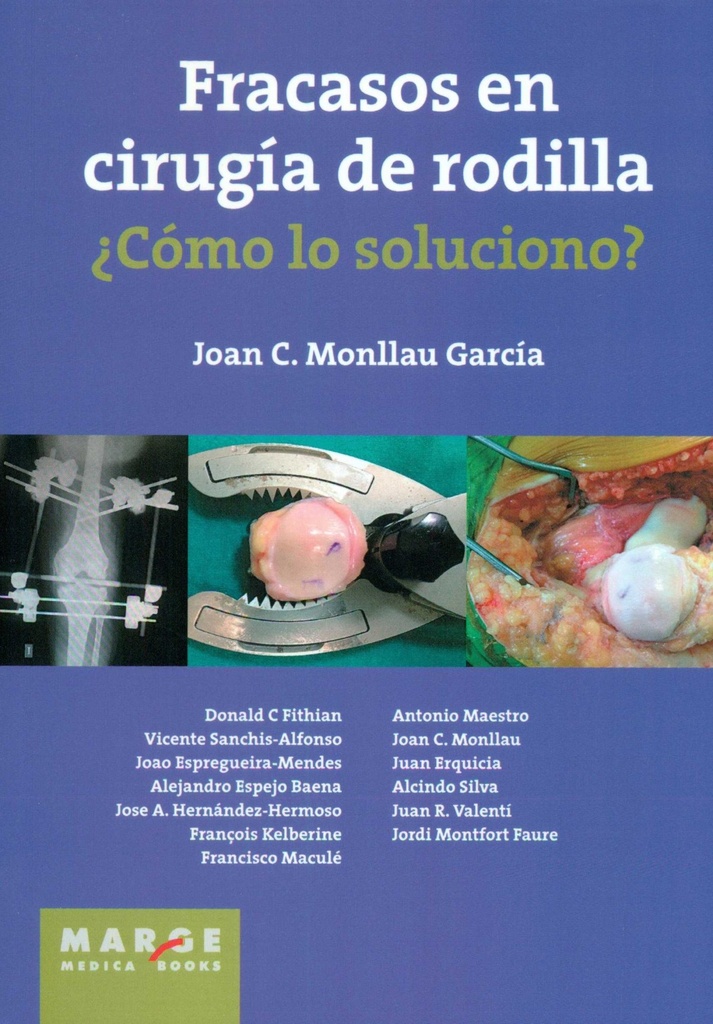 Fracasos en cirugia de rodilla.¿como lo soluciono?