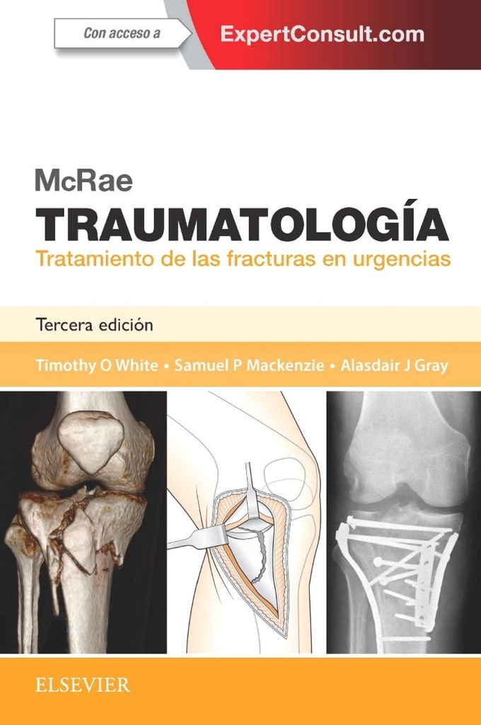 Mcrae.traumatología