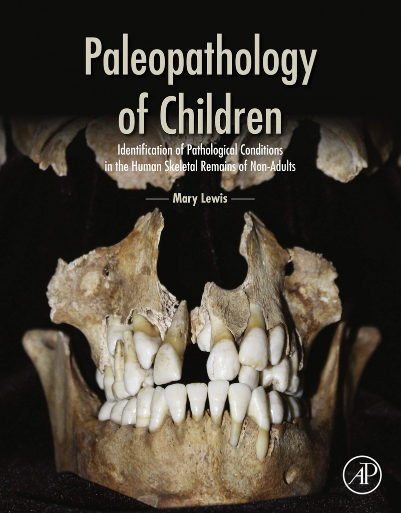 PALEOPATHOLOGY OF CHILDREN