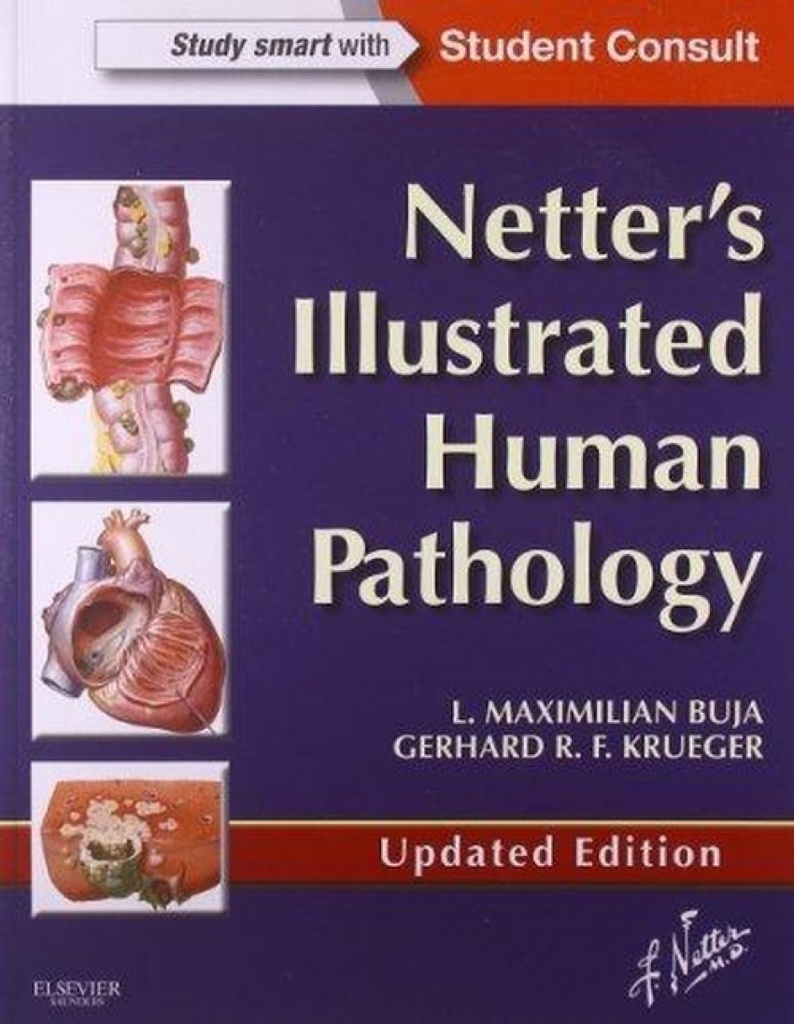 Netter´s Illustrated Human Pathology Updated Edition