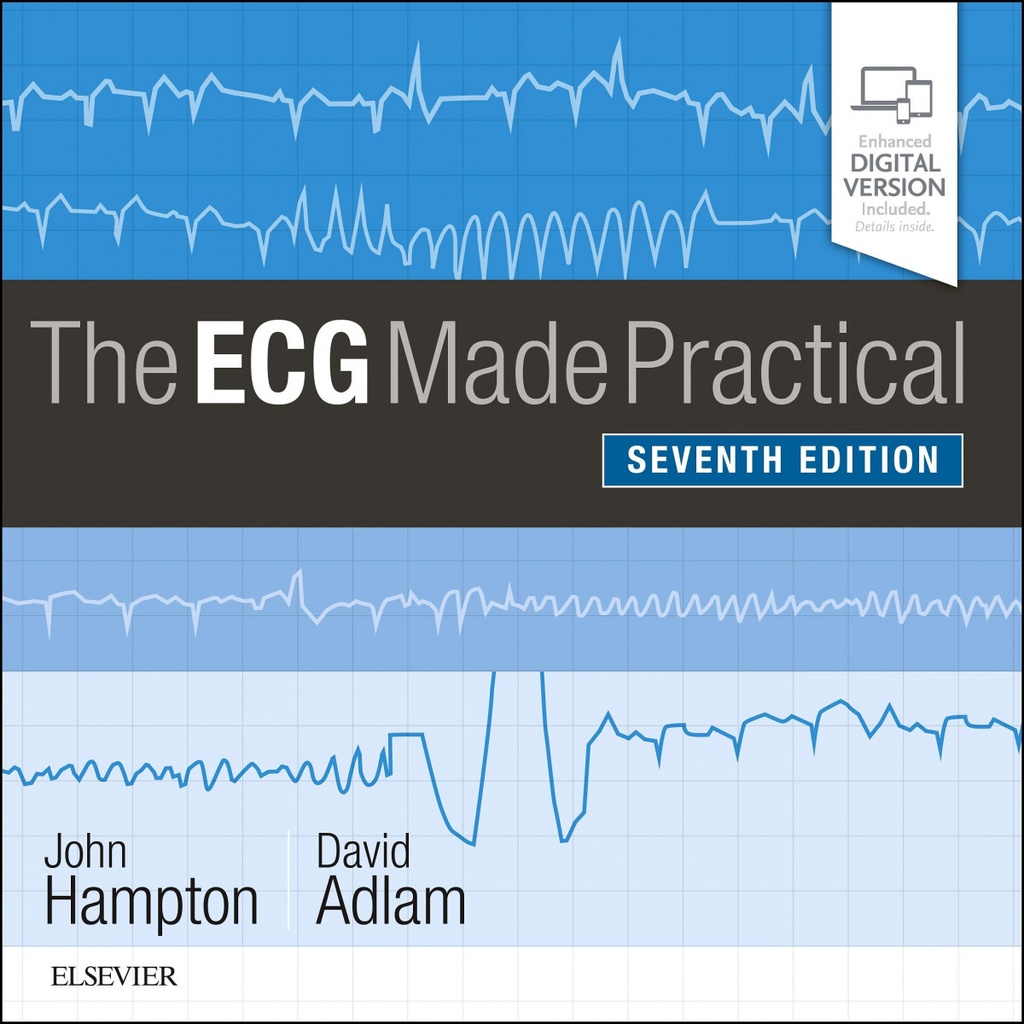 THE ECG MADE PRACTICAL