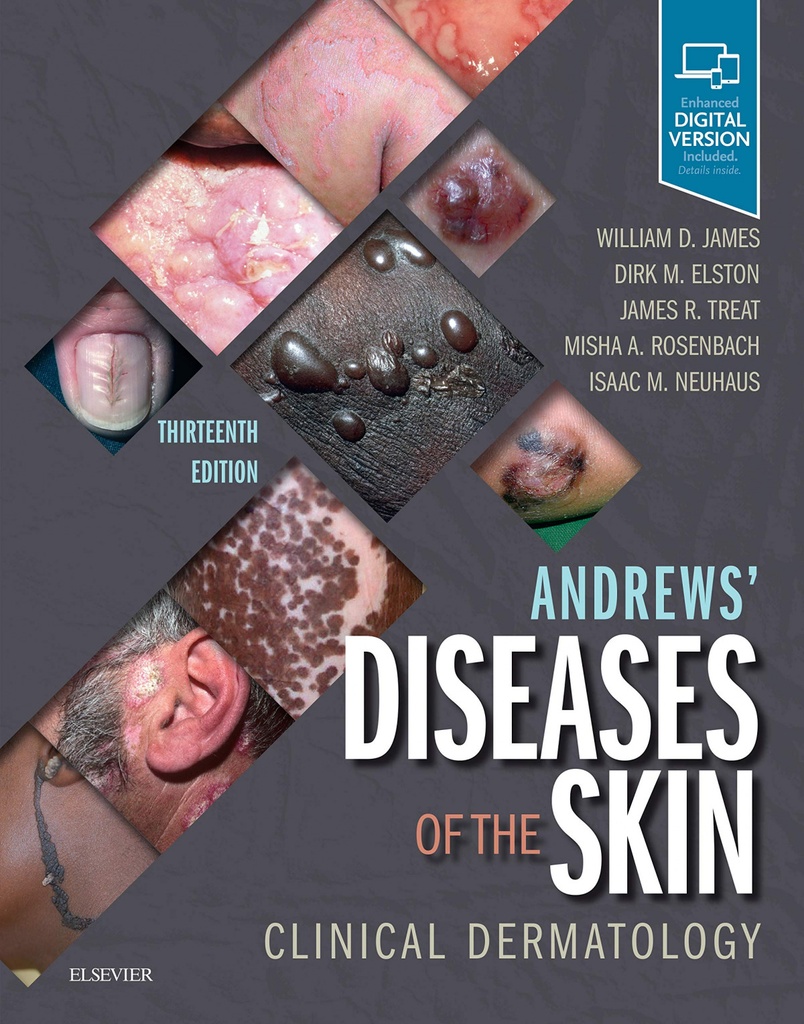 ANDREWS´ DISEASES OF THE SKIN