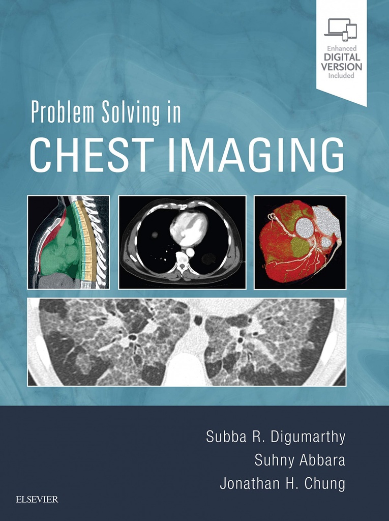 PROBLEM SOLVING IN CHEST IMAGING