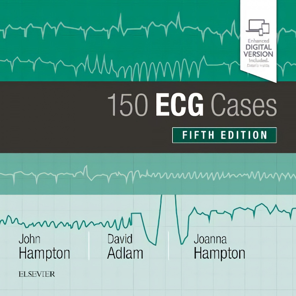 150 ECG CASES