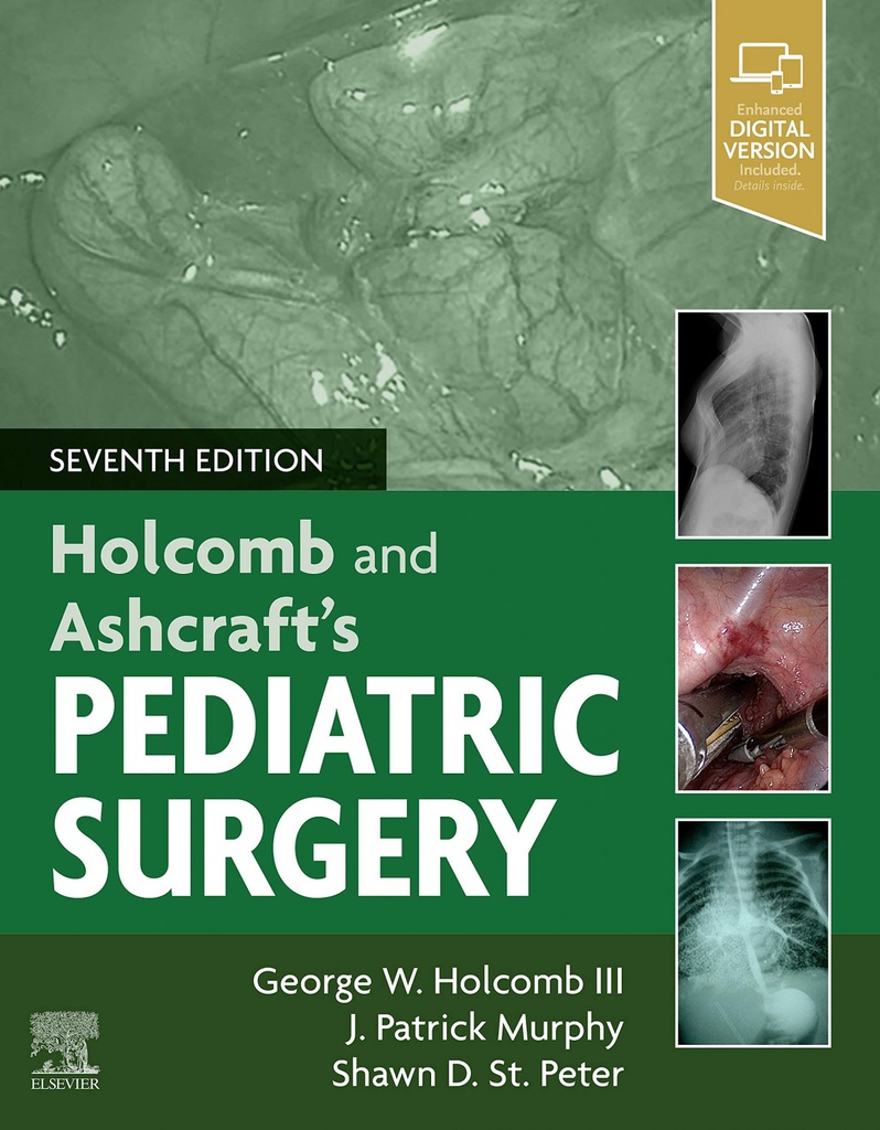 ASHCRAFT´S PEDIATRIC SURGERY