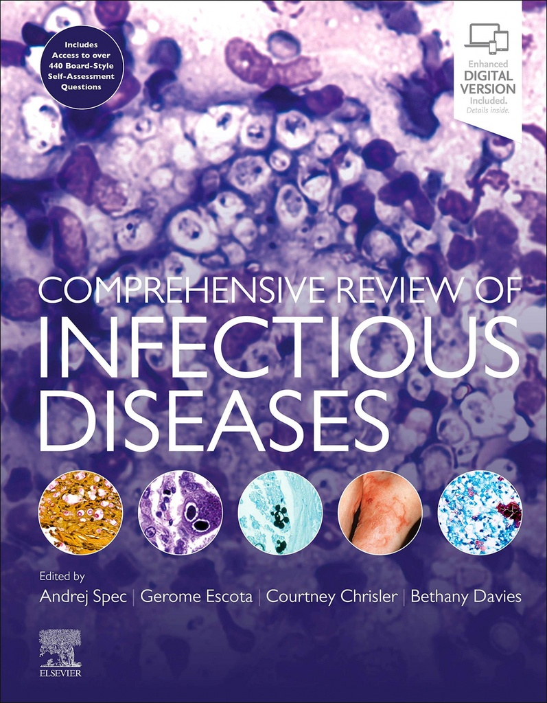 COMPREHENSIVE REVIEW OF INFECTIUS DISEASES