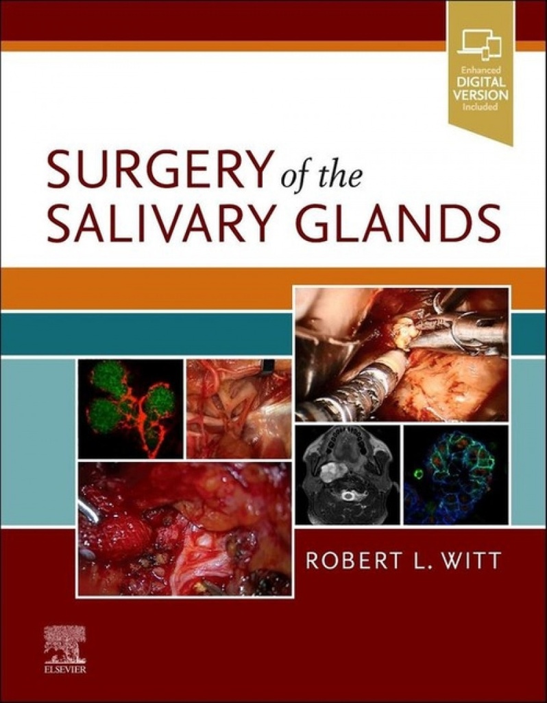 Surgery of the salivary glands