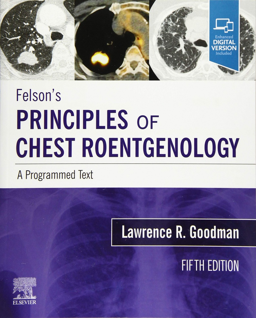 FELSON´S PRINCIPLES OF CHEST ROENTGENOLOGY A PROGRAMMED