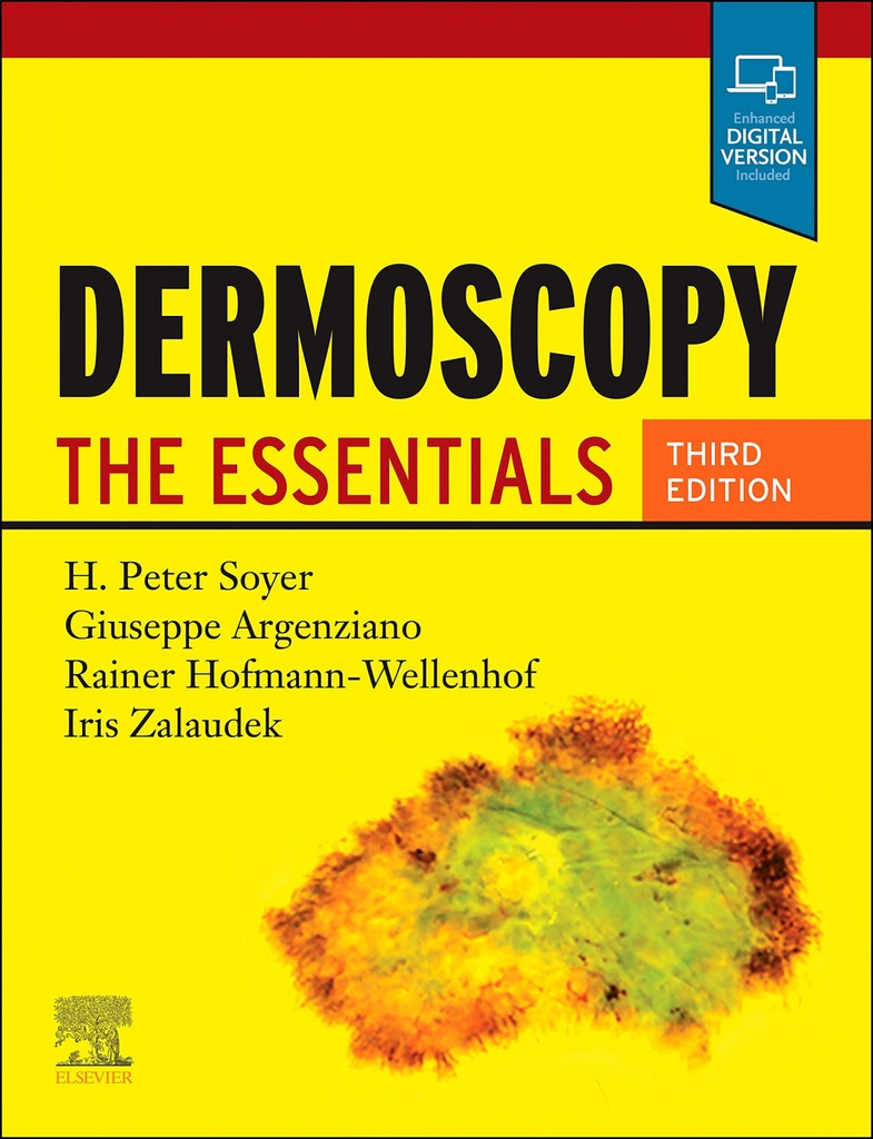 DERMOSCOPY.(3RD EDITION)