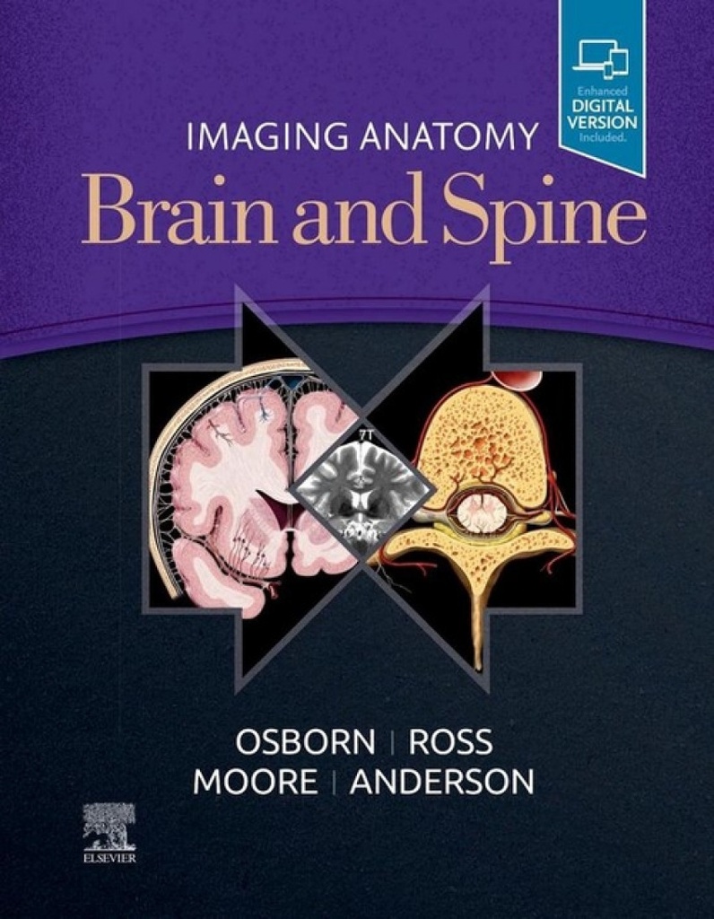 Imaging anatomy brain and spine