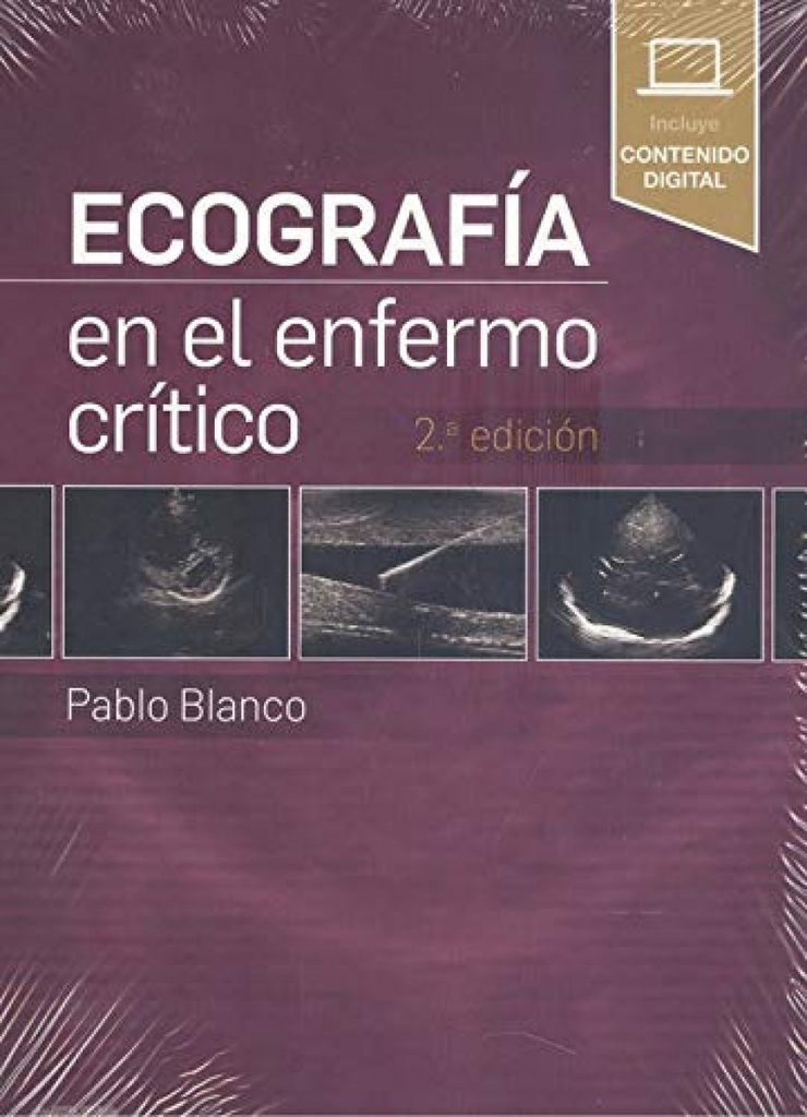 Ecografía en el enfermo crítico 2ª Edición