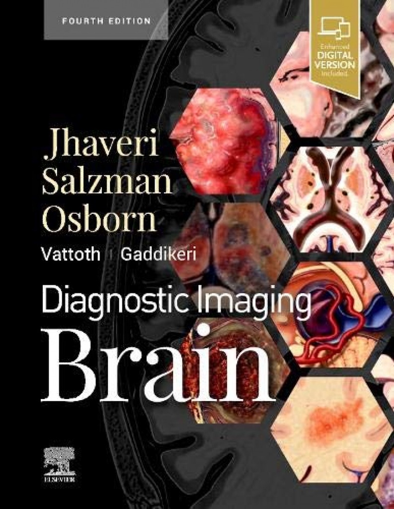 Diagnostic imaging brain