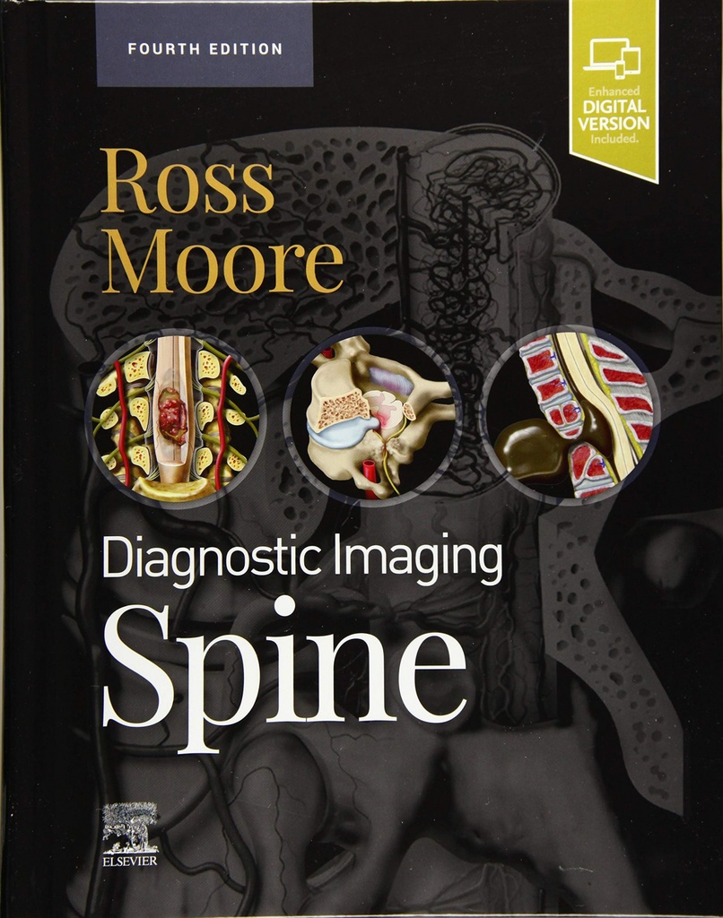 Diagnostic imaging: spine