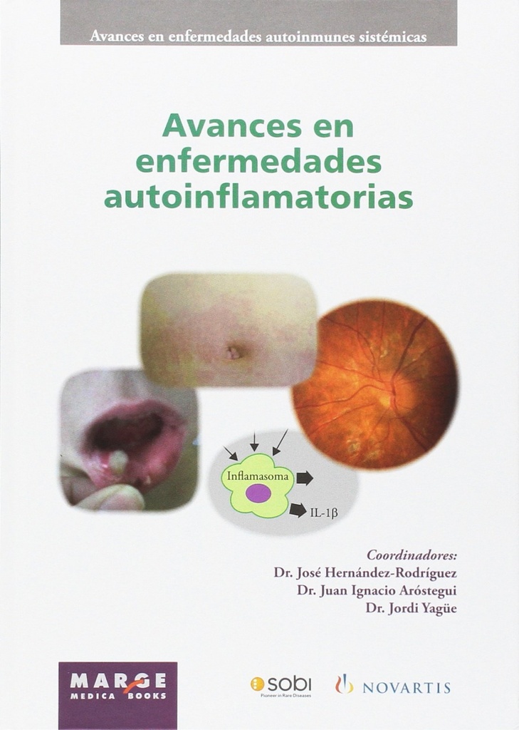 Avances en enfermedades autoinflamatorias