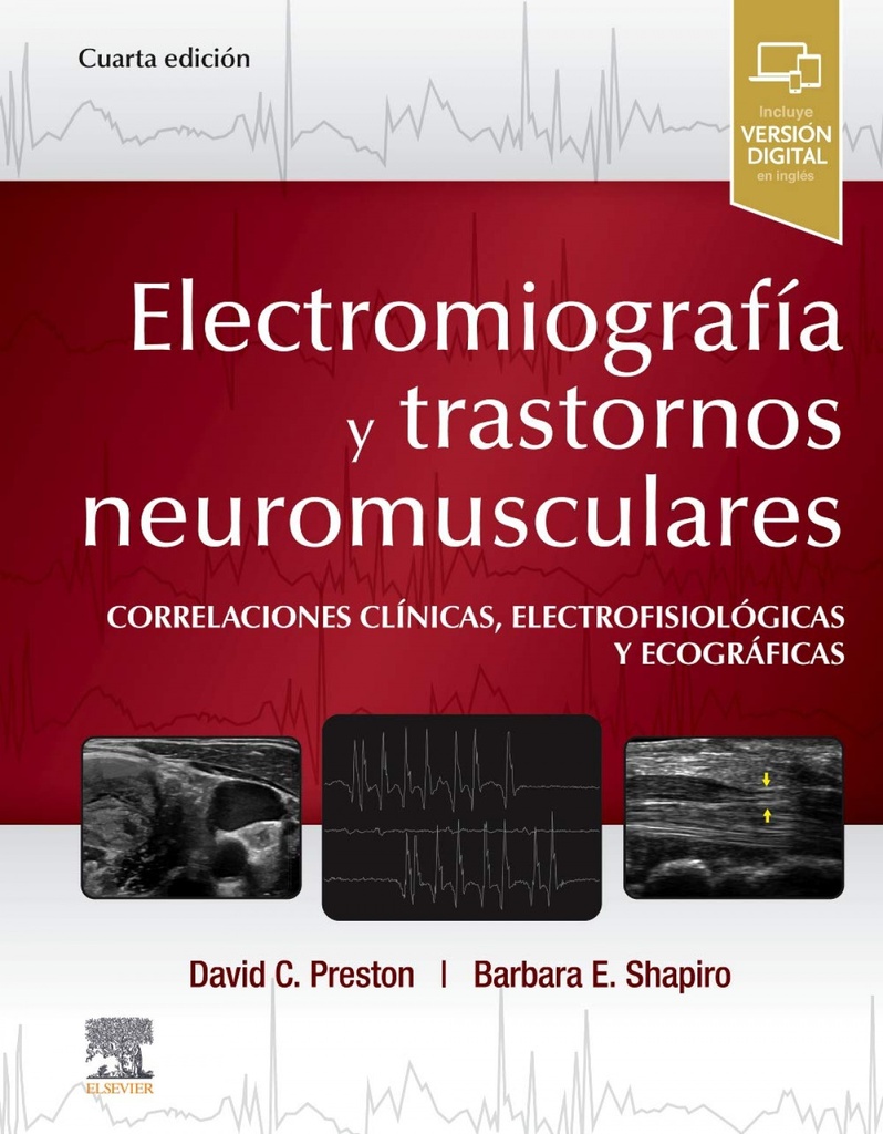 ELECTROMIOGRAFÍA Y TRASTORNOS NEUROMUSCULARES. CORRELACIONES CLÍNICAS, ELECTROFI