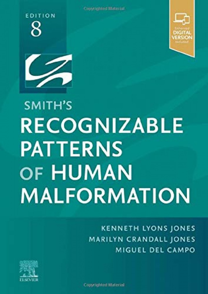 Smith´s recognizable patterns of human malformation