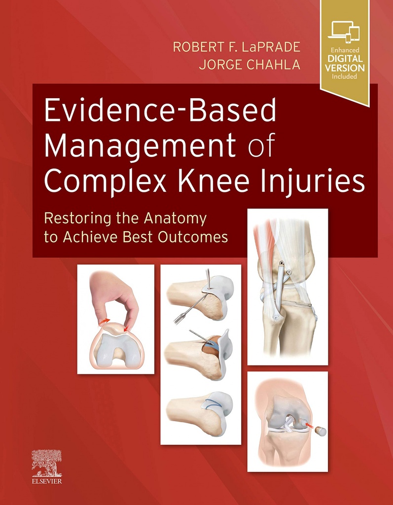 Evidence-based management of complex knee injuries