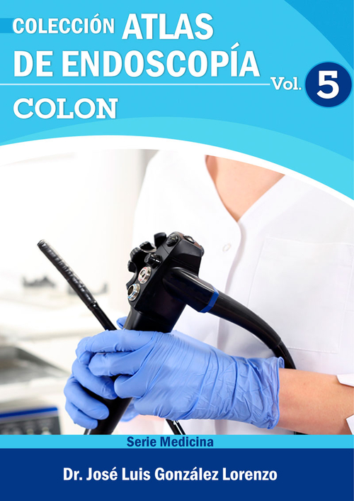 ATLAS DE ENDOSCOPÍA. VOLUMEN 5: COLON