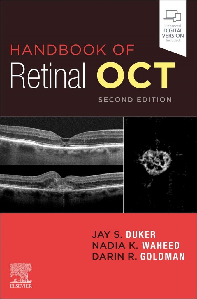 Handbook of retinal oct