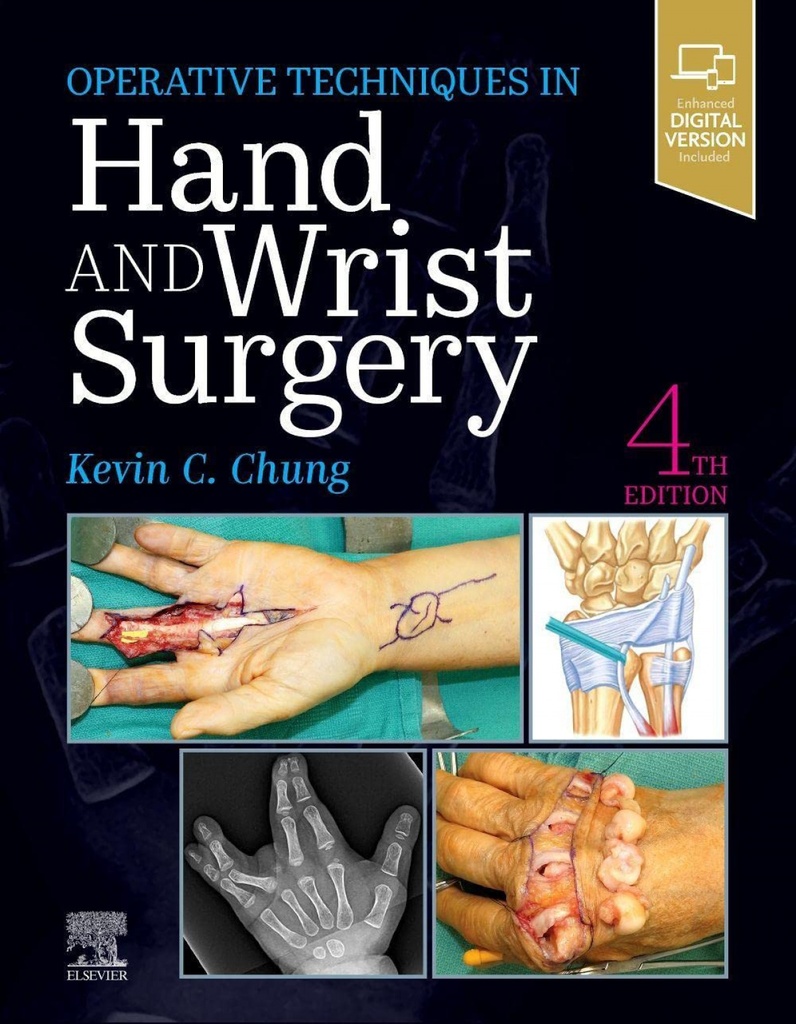 Operative techniques: hand and wrist surgery