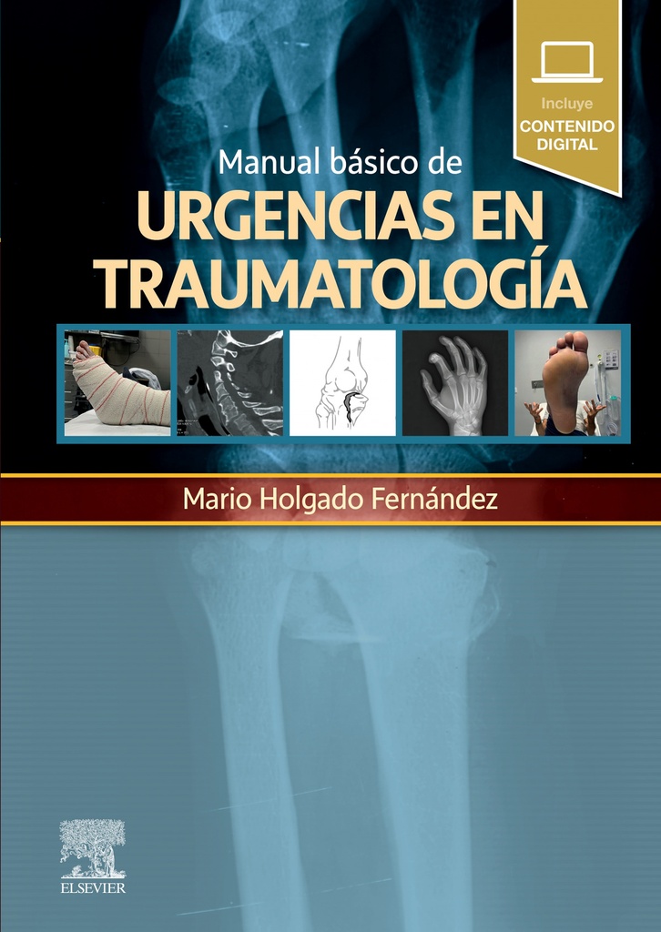 Manual básico de urgencias en traumatología