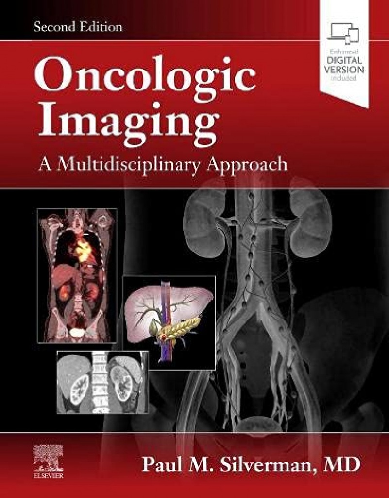 Oncology imaging:a multidisciplinary approach