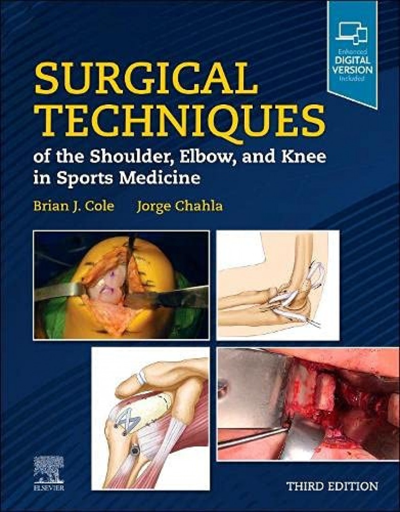 SURGICAL TECHNIQUES OF THE SHOULDER,ELBOW,KNEE SPORTS