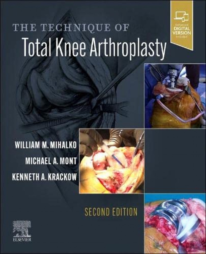 THE TECHNIQUE OF TOTAL KNEE ARTHROPLASTY 2ND EDITION