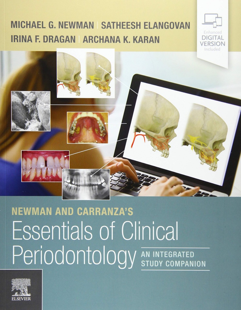 NEWMAN AND CARRANZA´S ESSENTIALS OF CLINICAL PERIODONTOLOGY