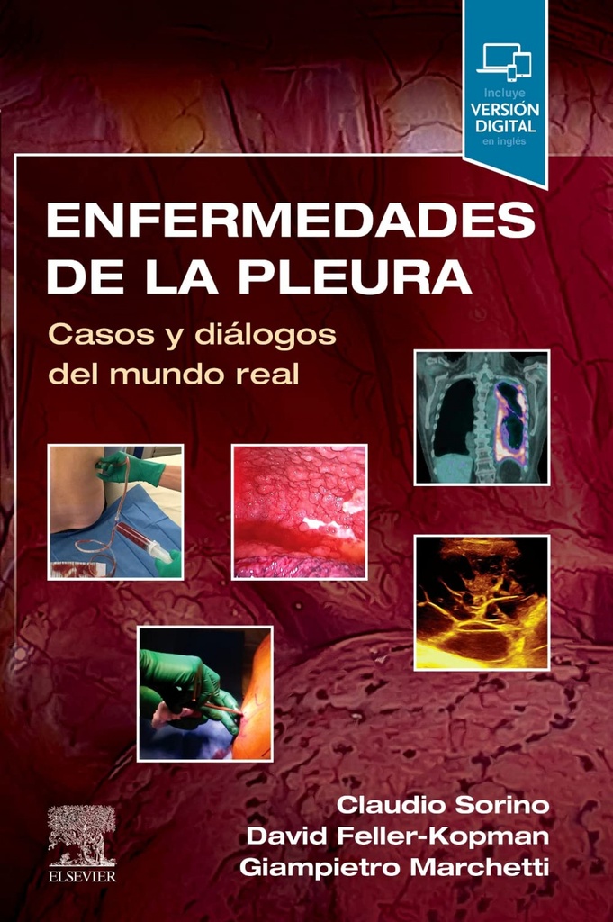 Enfermedades de la pleura