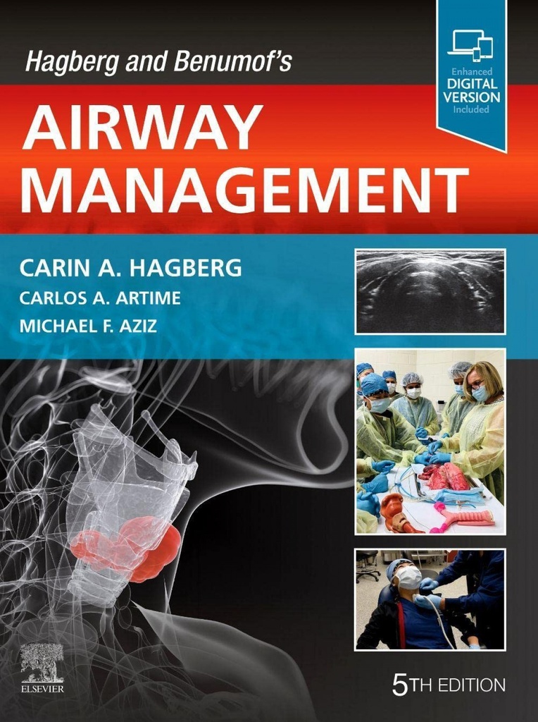 Hagberg and benumof´s airway management