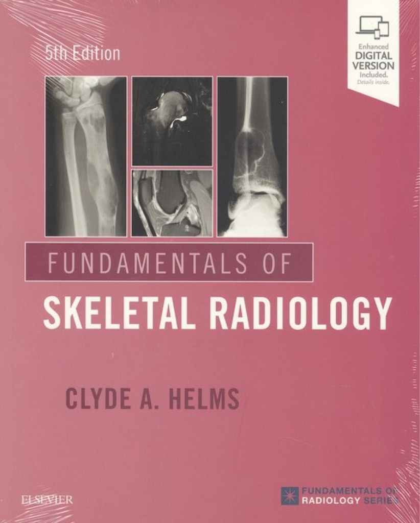 FUNDAMENTALS OF SKELETAL RADIOLOGY