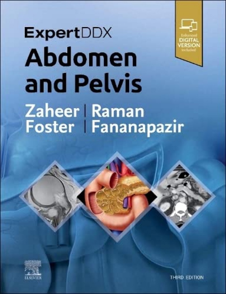 Expertddx:abdomen and pelvis