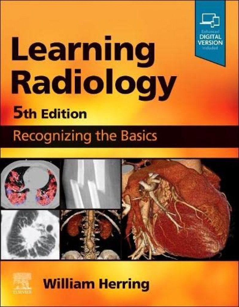 LEARNING RADIOLOGY