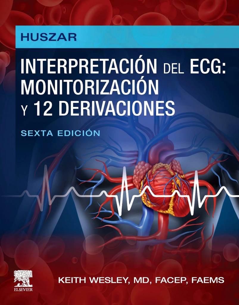 Huszar:interpretacion  ecg:monitorizacion 12 derivaciones