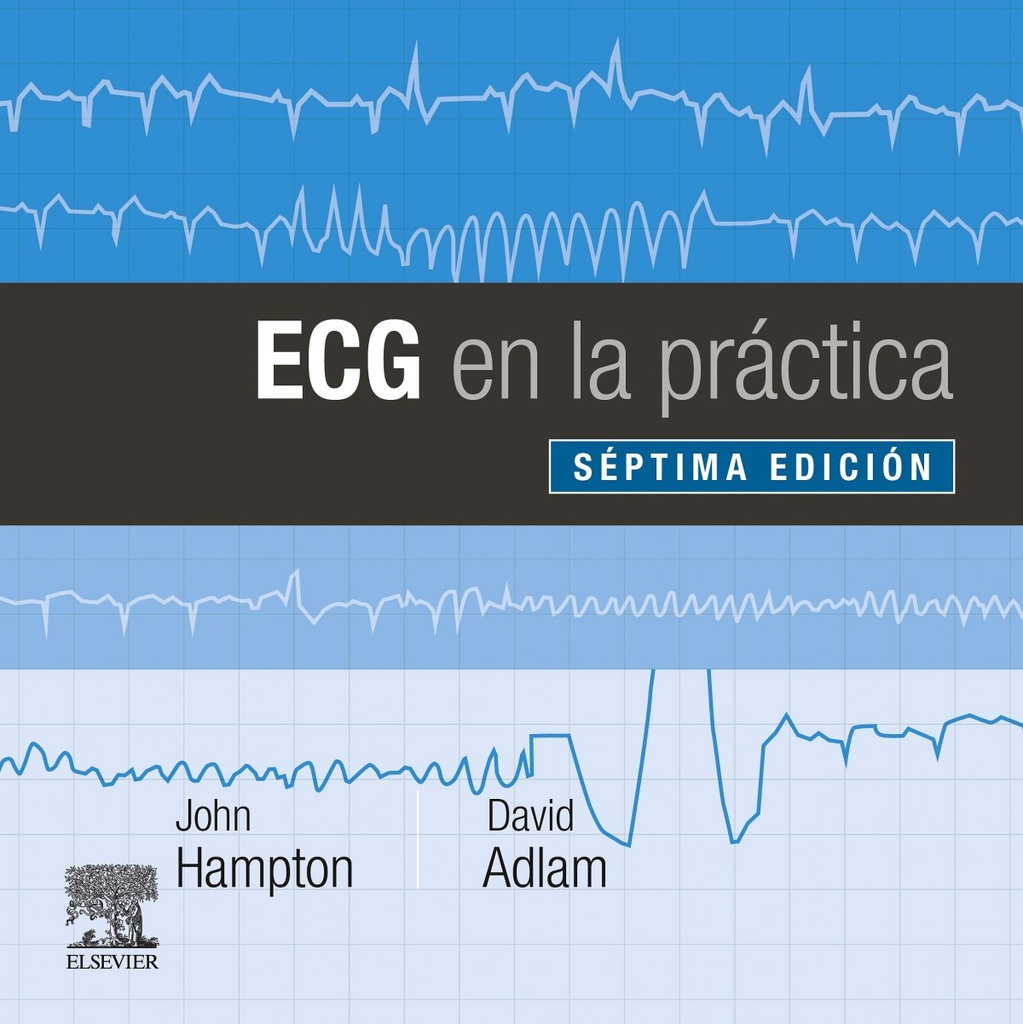 ECG EN LA PRÁCTICA