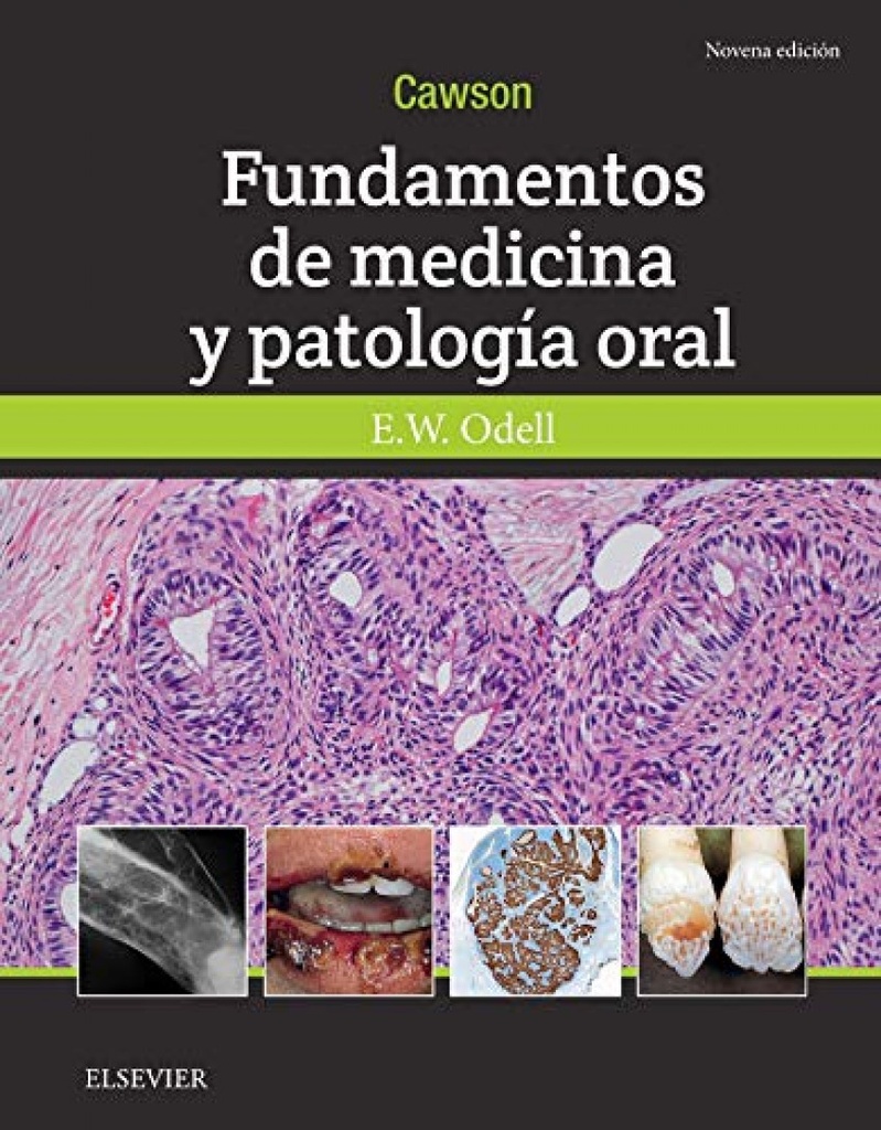 CAWSON. FUNDAMENTOS DE MEDICINA Y PATOLOGÍA ORAL