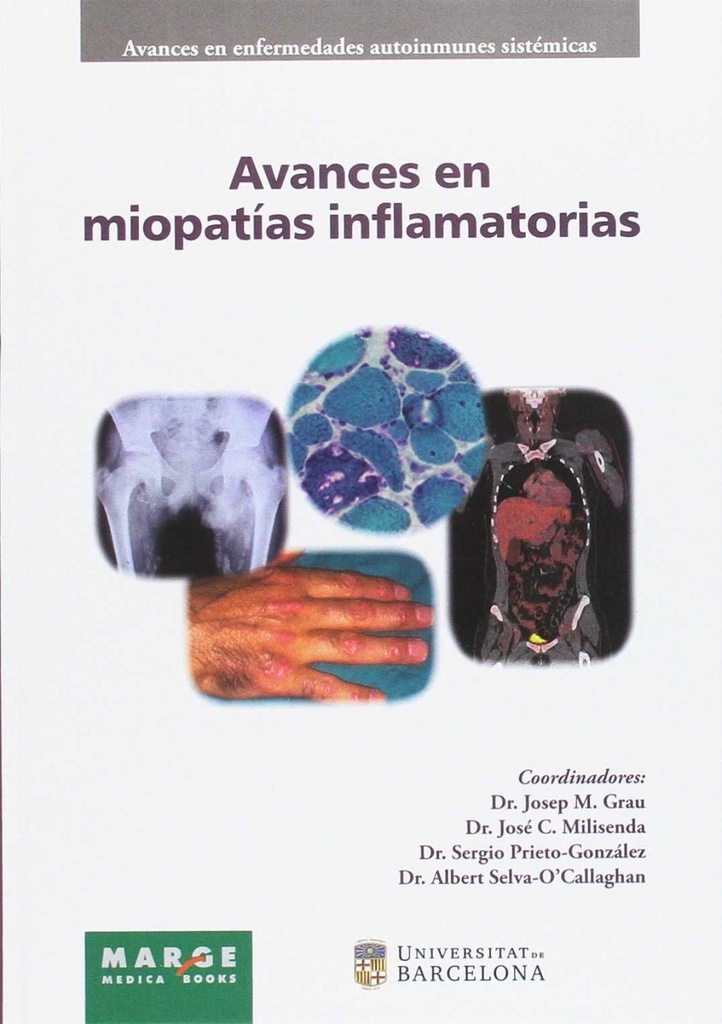 AVANCES EN MIOPATIAS INFLAMATORIAS