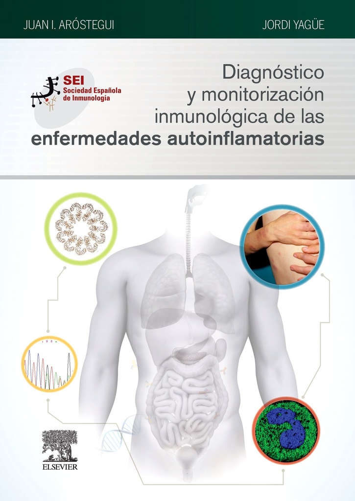 DIAGNÓSTICO Y MONITORIZACIÓN INMUNOLÓGICA DE LAS ENFERMEDADES AUTOINFLAMATORIAS