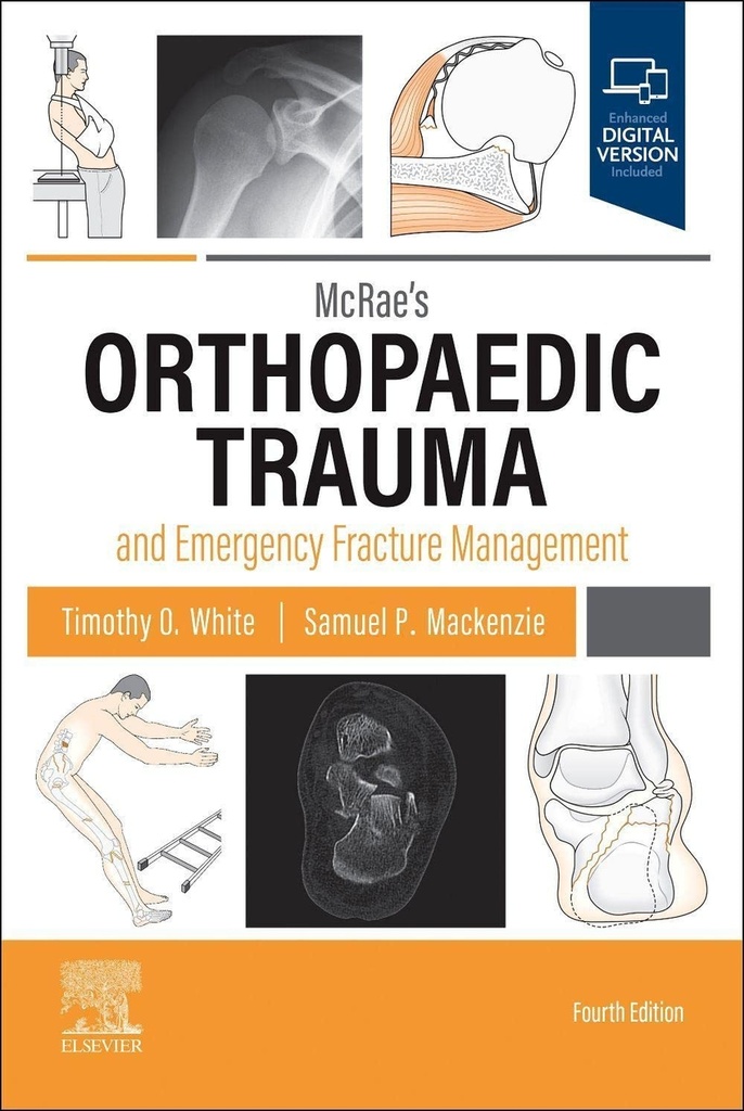 Mcrae´s orthopaedic trauma emergency fracture management