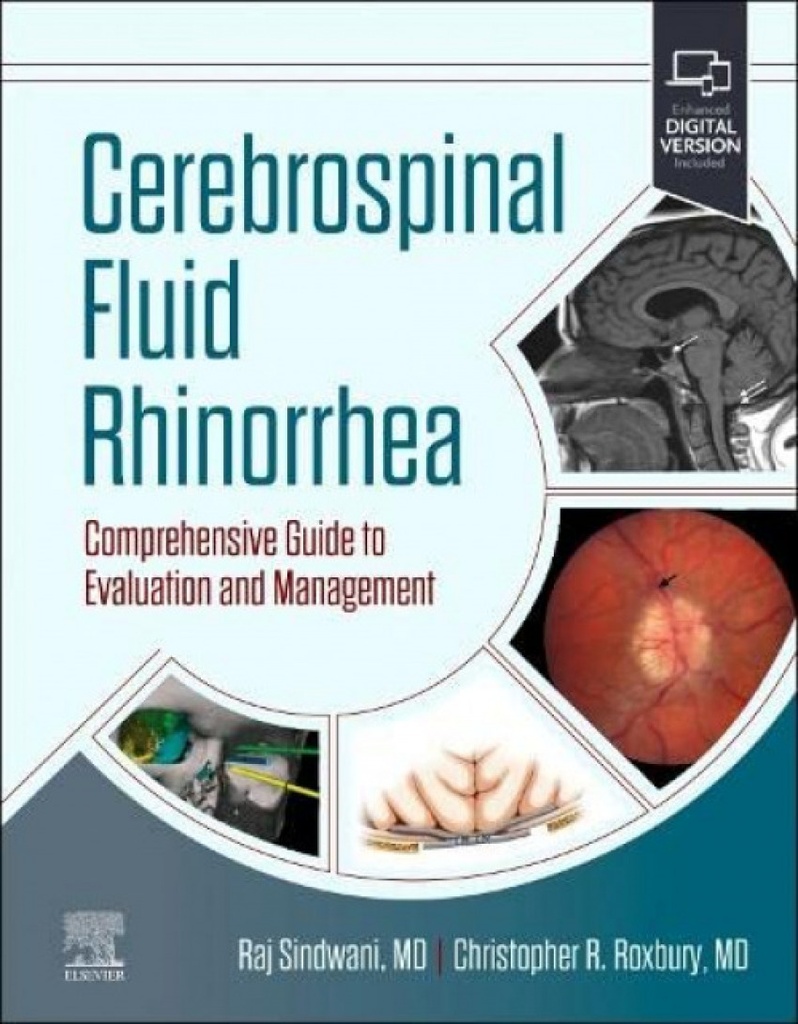 Cerebrospinal fluid rhinorrhea